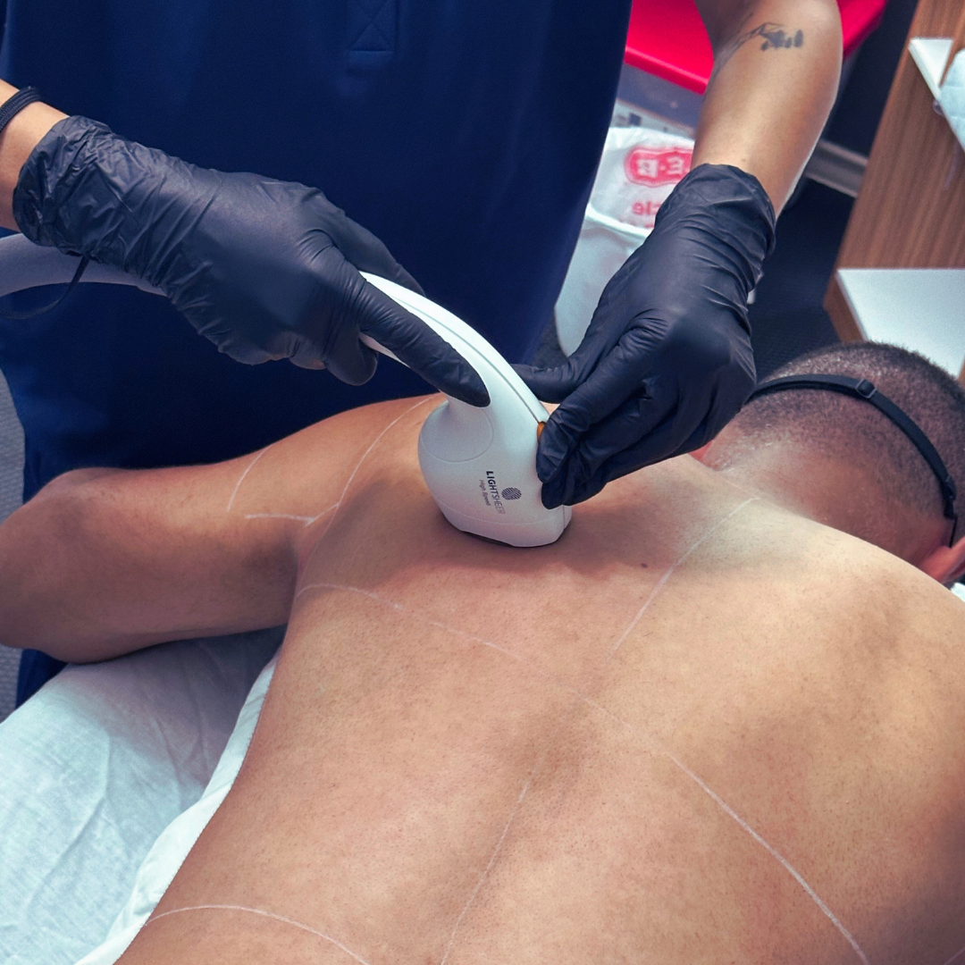 Back Hair Removal for Men Options Cost Other Considerations